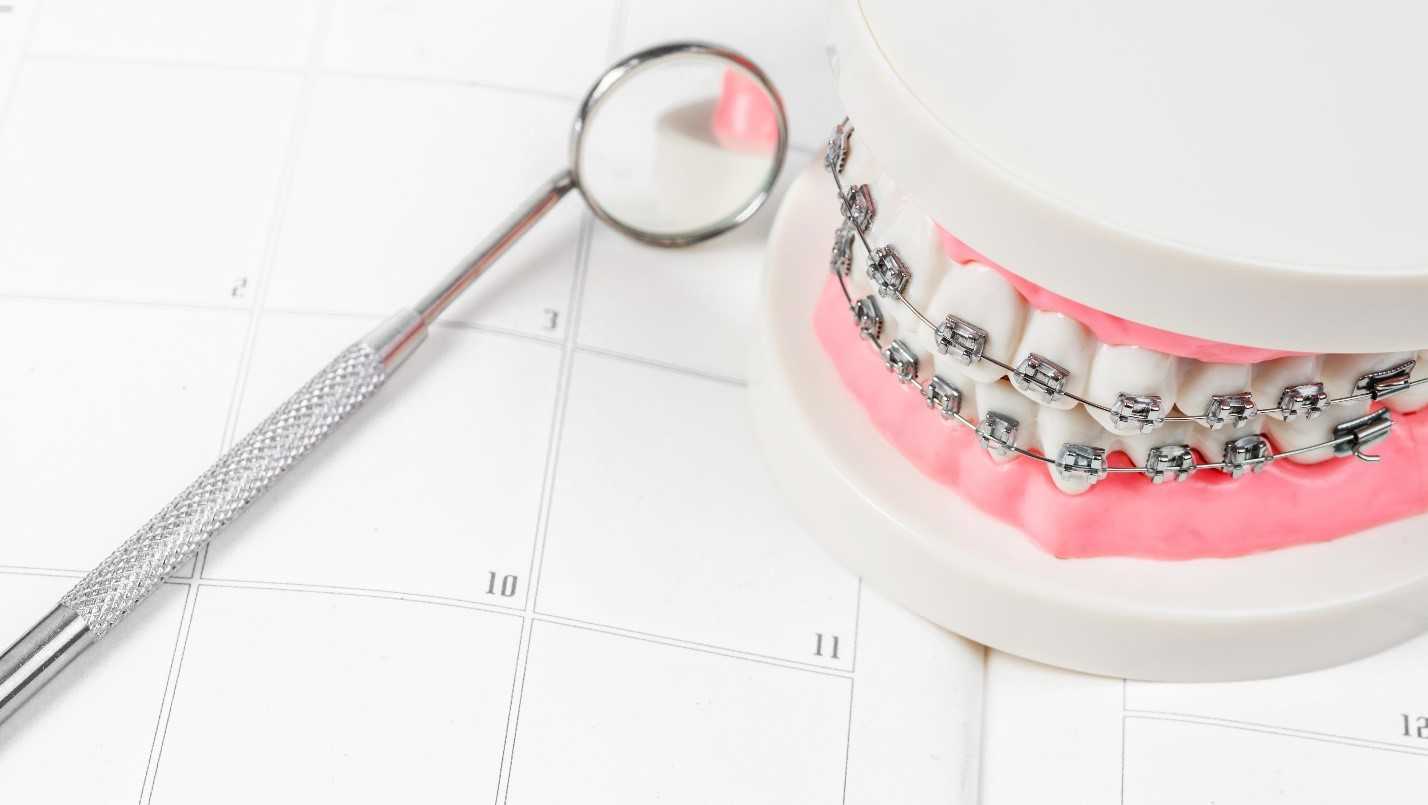 Calendar Showing Frequency Of Orthodontic Appointments