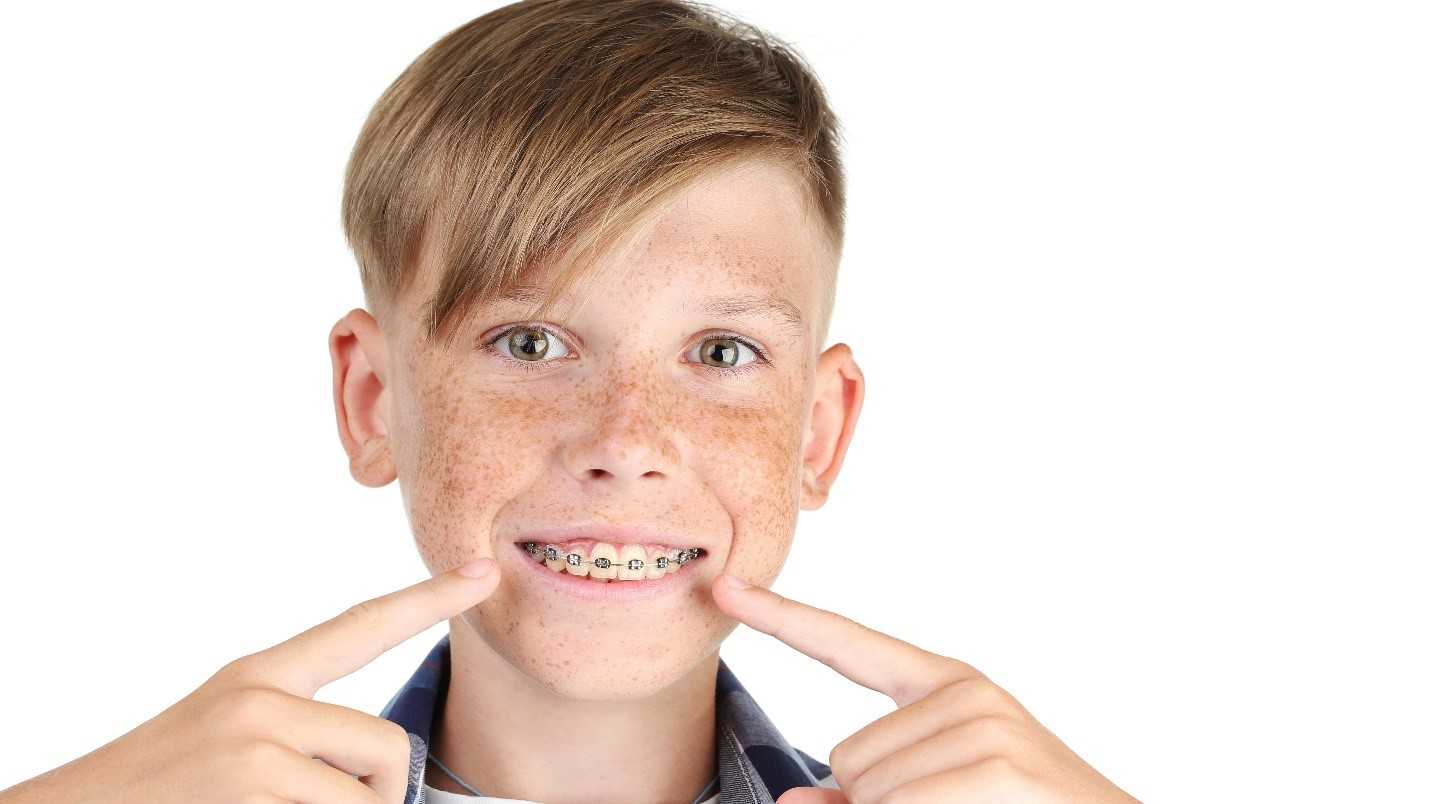 boy smiles and points at his braces