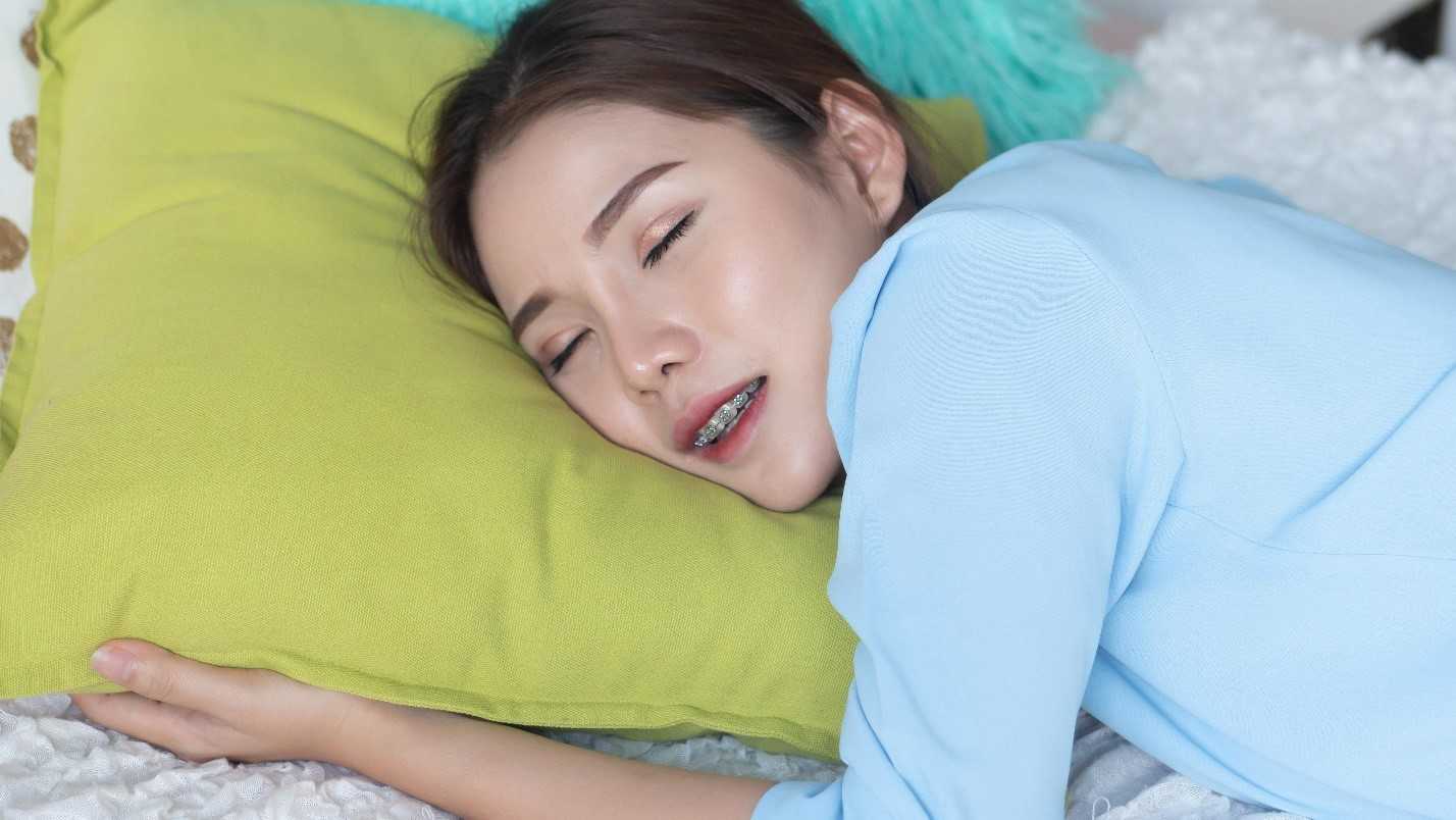 Woman sleeps while wearing orthodontic wax on braces